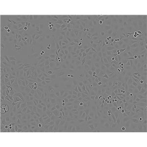 NCI-H250 Cells(赠送Str鉴定报告)|人小细胞肺癌细胞,NCI-H250 Cells