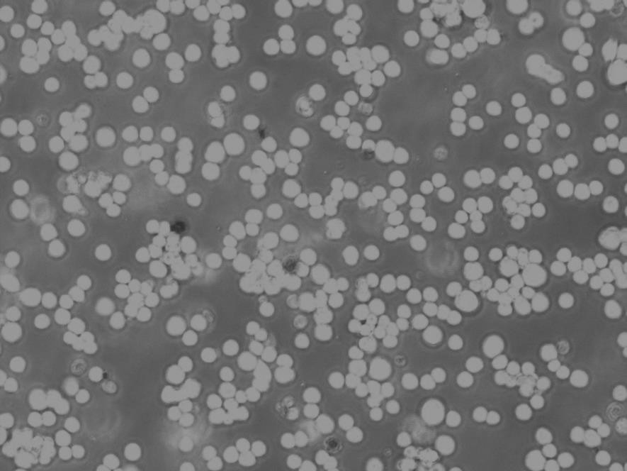 CCRF-CEM Cells|人急性淋巴細(xì)胞白血病T淋巴克隆細(xì)胞(包送STR鑒定報告),CCRF-CEM Cells