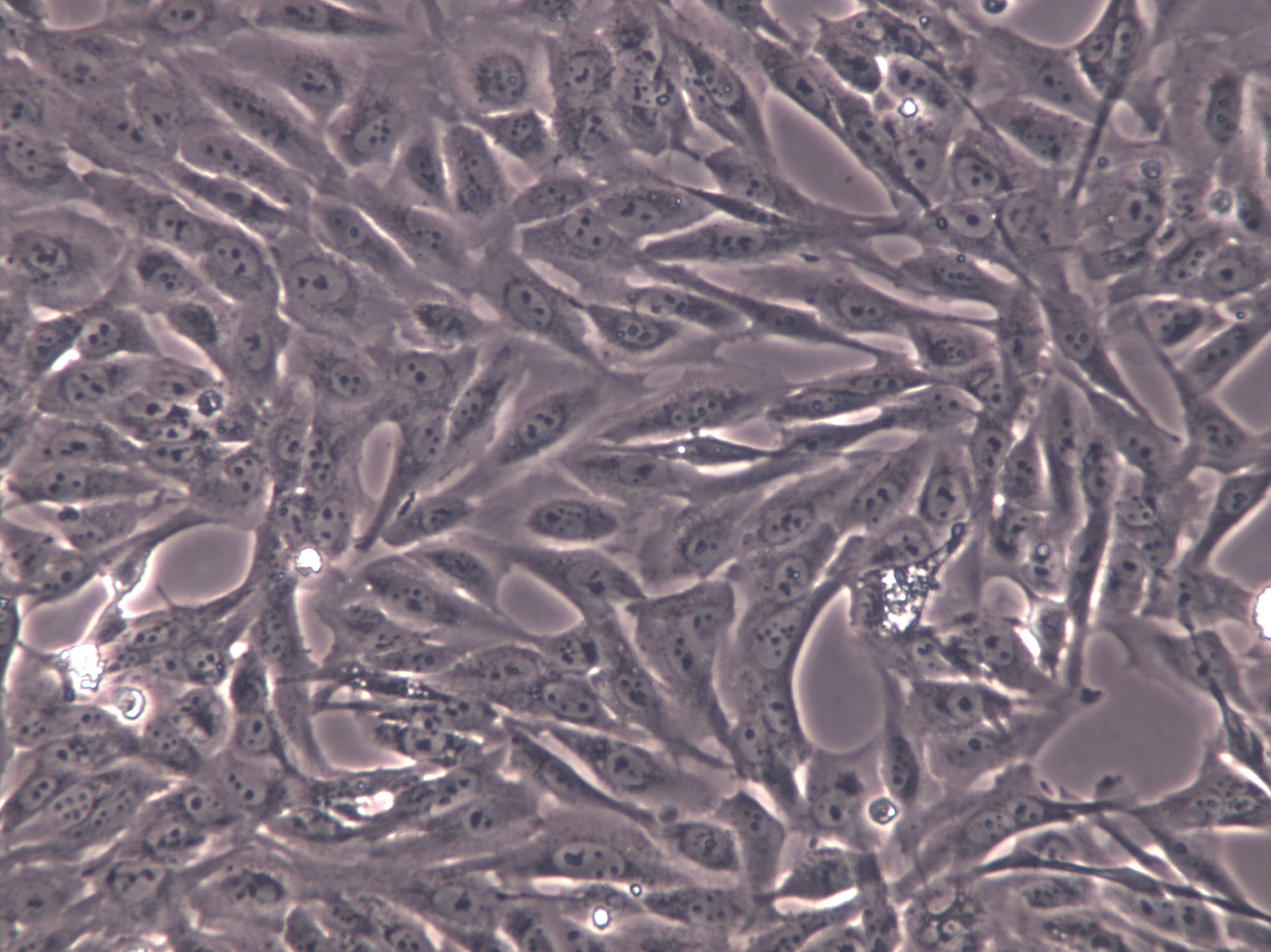 OVCA433 Cells(赠送Str鉴定报告)|人卵巢癌细胞,OVCA433 Cells