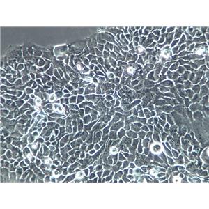4-1st Cells(赠送Str鉴定报告)|人胃癌细胞