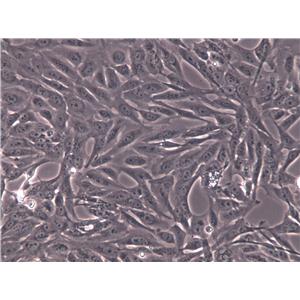 OVCA433 Cells(赠送Str鉴定报告)|人卵巢癌细胞
