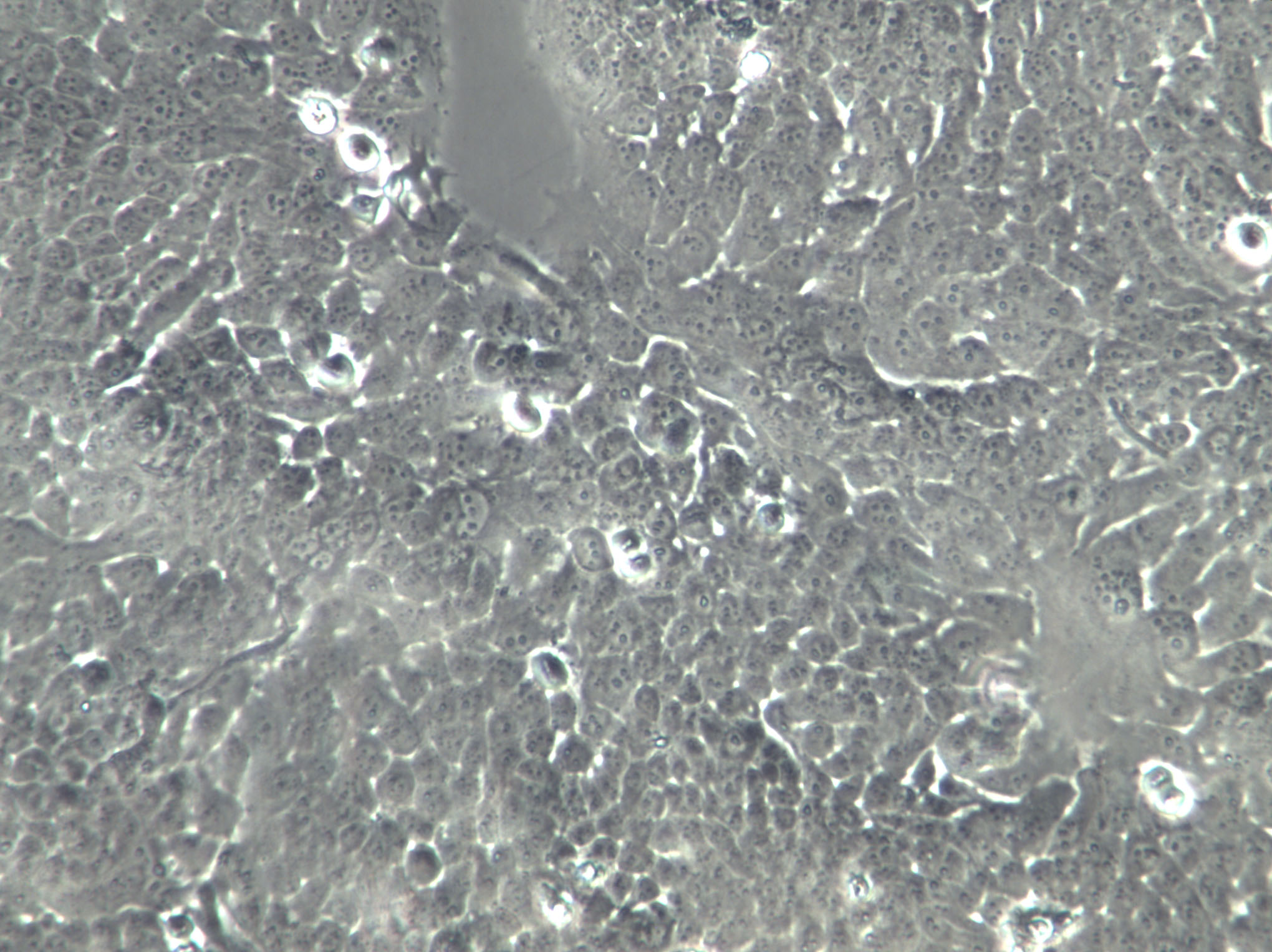 OVCAR-3 Cells|人卵巢腺癌克隆细胞,OVCAR-3 Cells