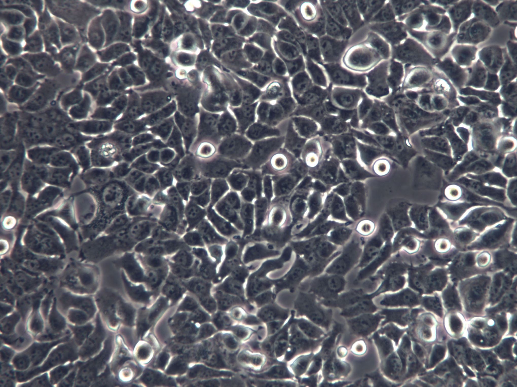 KMH-2 Cells(赠送Str鉴定报告)|人甲状腺癌细胞,KMH-2 Cells
