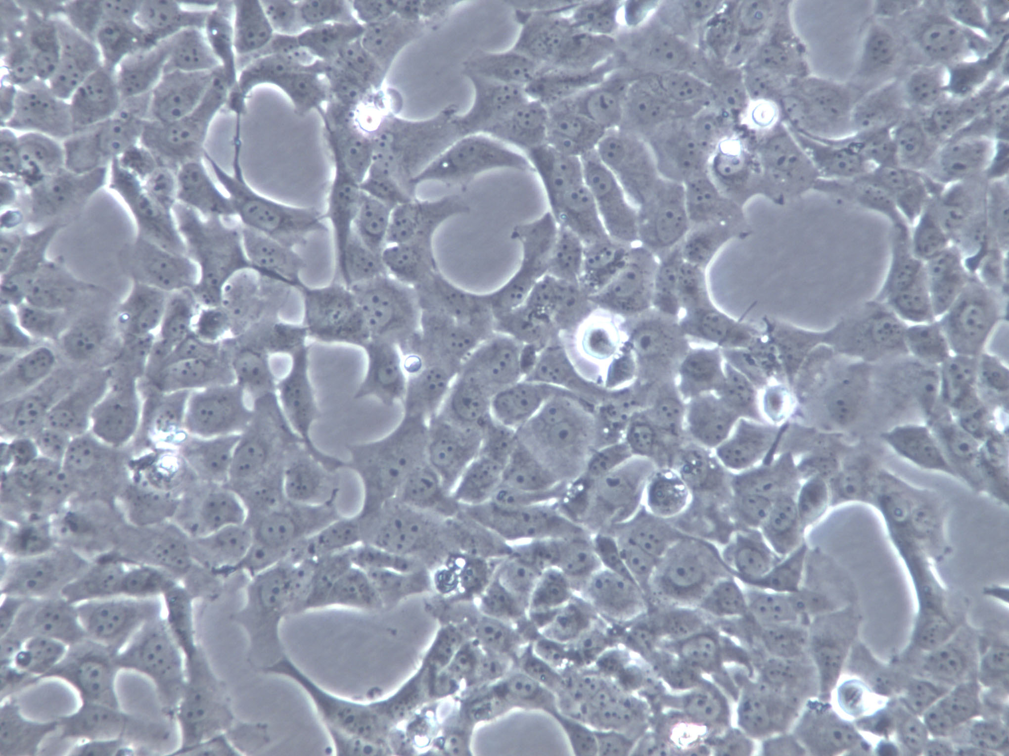 K1735 Cells(赠送Str鉴定报告)|小鼠黑色素瘤细胞,K1735 Cells