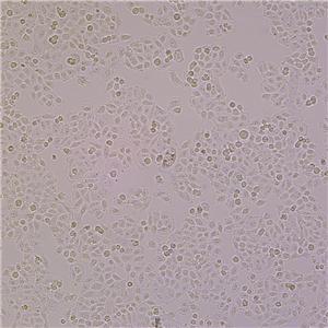BGC-823（人胃腺癌细胞（低分化））