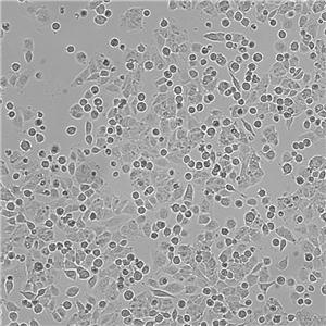 HCCLM3（人高轉(zhuǎn)移肝癌細(xì)胞）