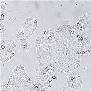 NCI-N87 [N87]（人胃癌细胞）,NCI-N87