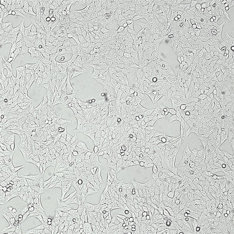 Hep 3B2.1-7（人肝癌细胞）,Hep 3B2.1-7