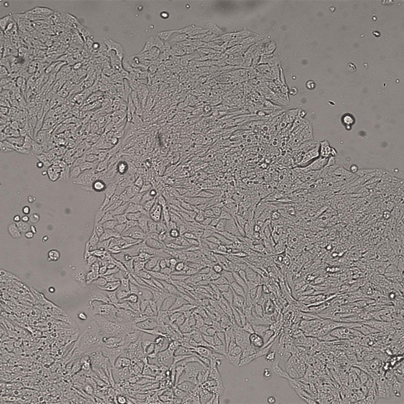 SW480人結(jié)腸腺癌細(xì)胞,SW480