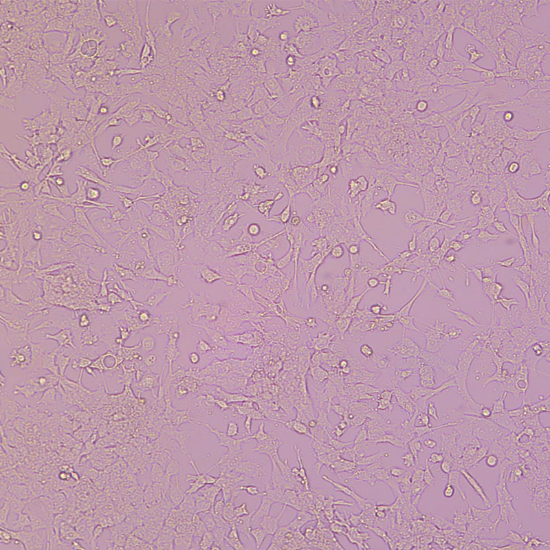 GL261（小鼠胶质瘤细胞）,GL261