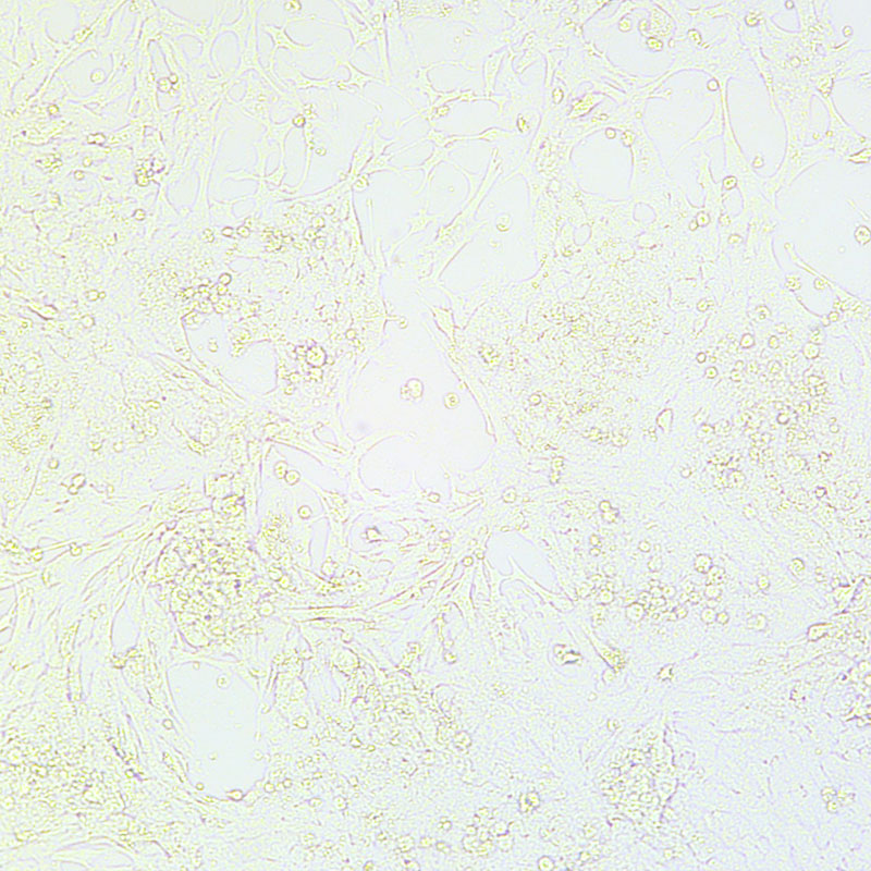 Hepa1-6（小鼠肝癌细胞）,Hepa1-6