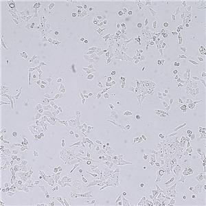 P19（小鼠睾丸畸胎瘤细胞）