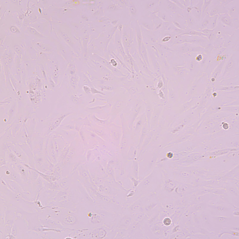 SW1353人軟骨肉瘤細(xì)胞,SW1353