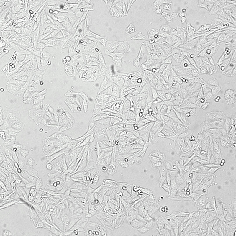 Saos-2人成骨肉瘤細胞,Saos-2