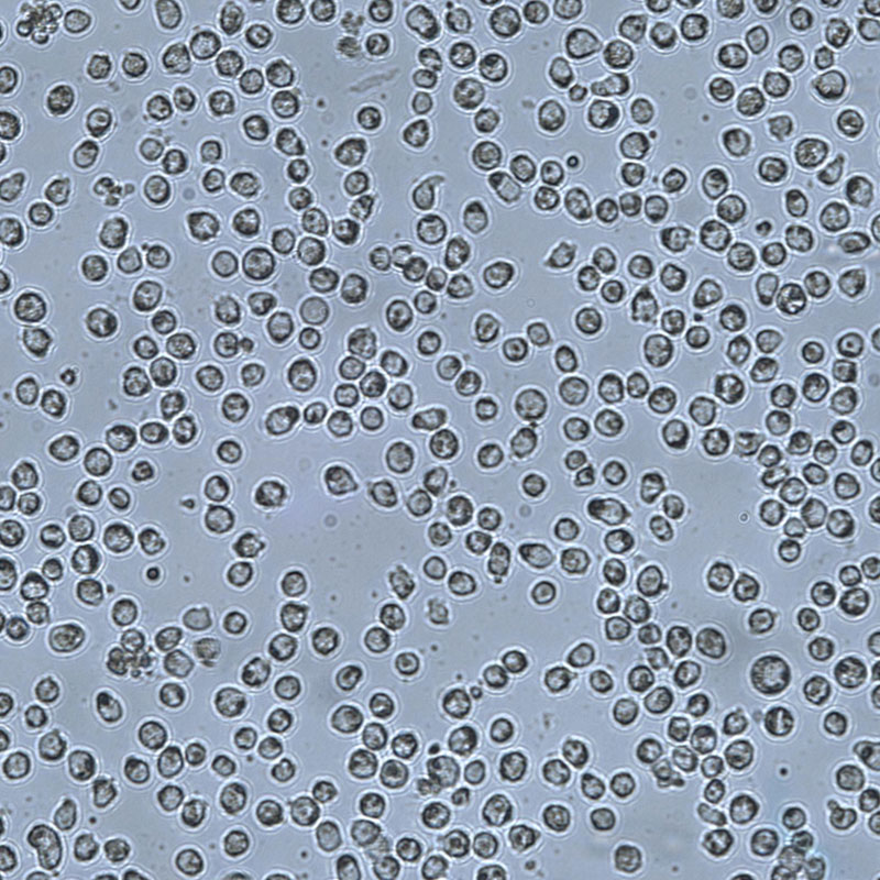 U-937人组织细胞淋巴瘤细胞,U-937