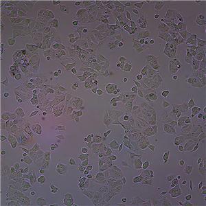MCF7人乳腺癌细胞