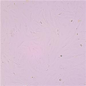 SW1353:人软骨肉瘤复苏细胞(提供STR鉴定图谱)价格1500元/ASSAYS 厂家 