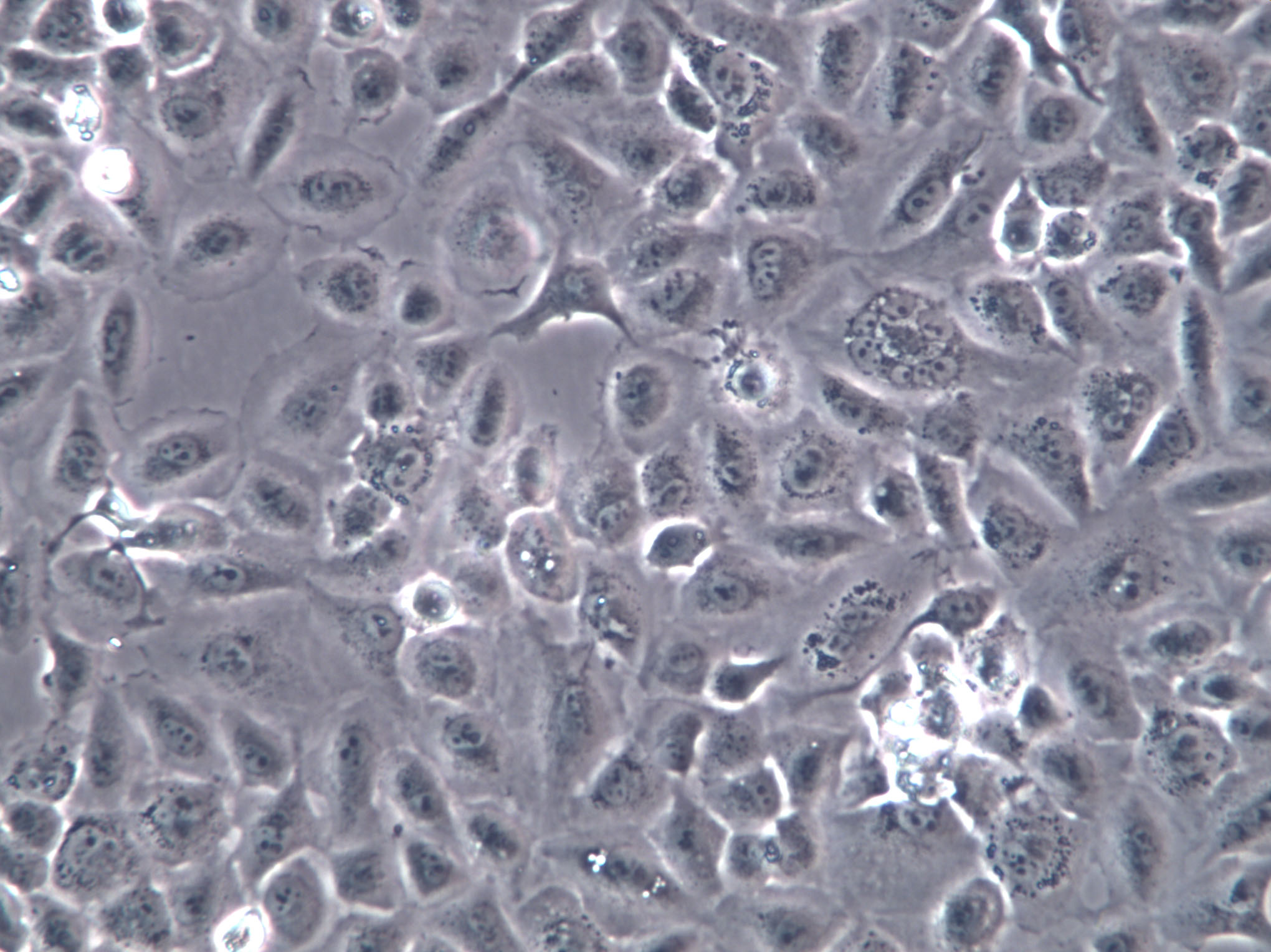 UPCI-SCC-154 Cells(赠送Str鉴定报告)|人舌鳞癌细胞,UPCI-SCC-154 Cells