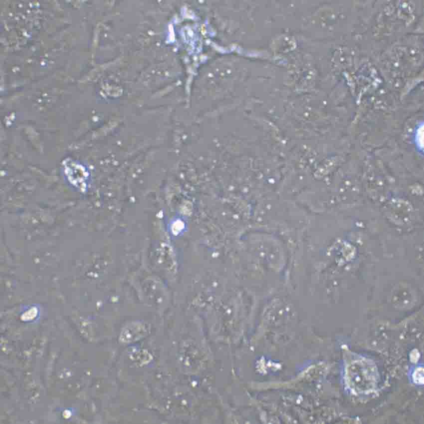 NCI-H125 Cells(赠送Str鉴定报告)|人非小细胞肺癌细胞,NCI-H125 Cells