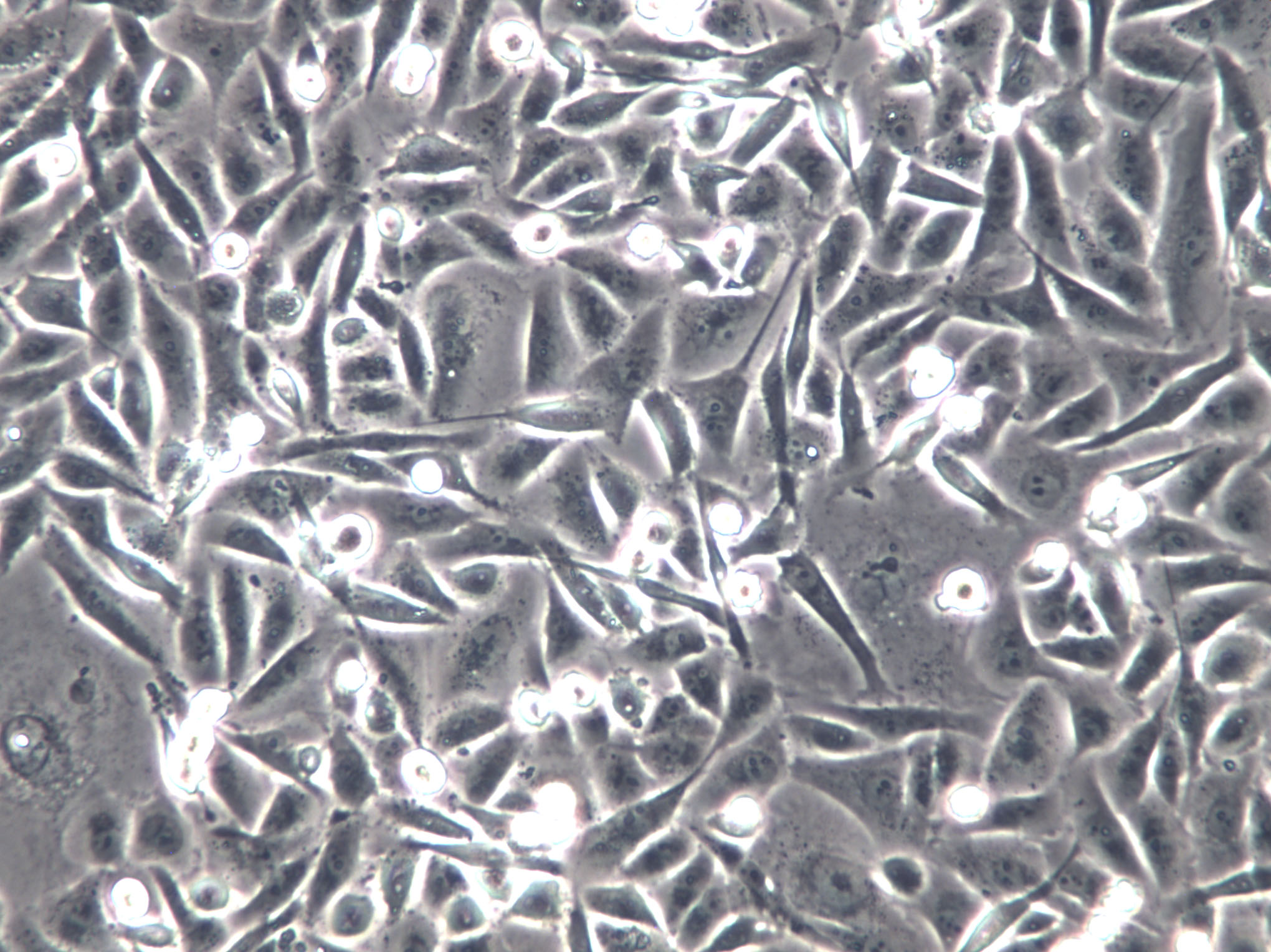 MuM-2B Cells(赠送Str鉴定报告)|人眼脉络黑色素瘤细胞,MuM-2B Cells