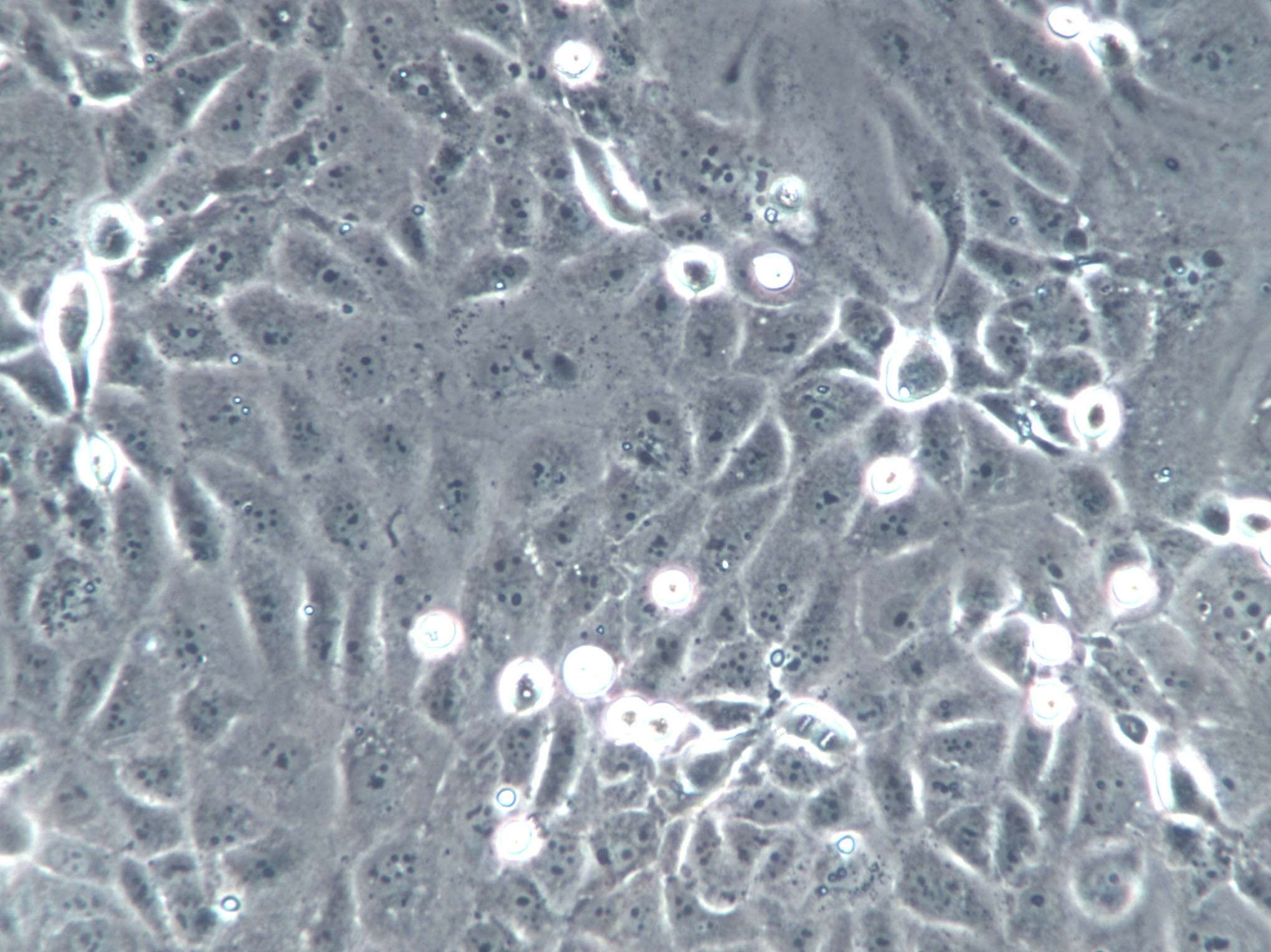 JC Cells(赠送Str鉴定报告)|小鼠乳腺癌细胞,JC Cells