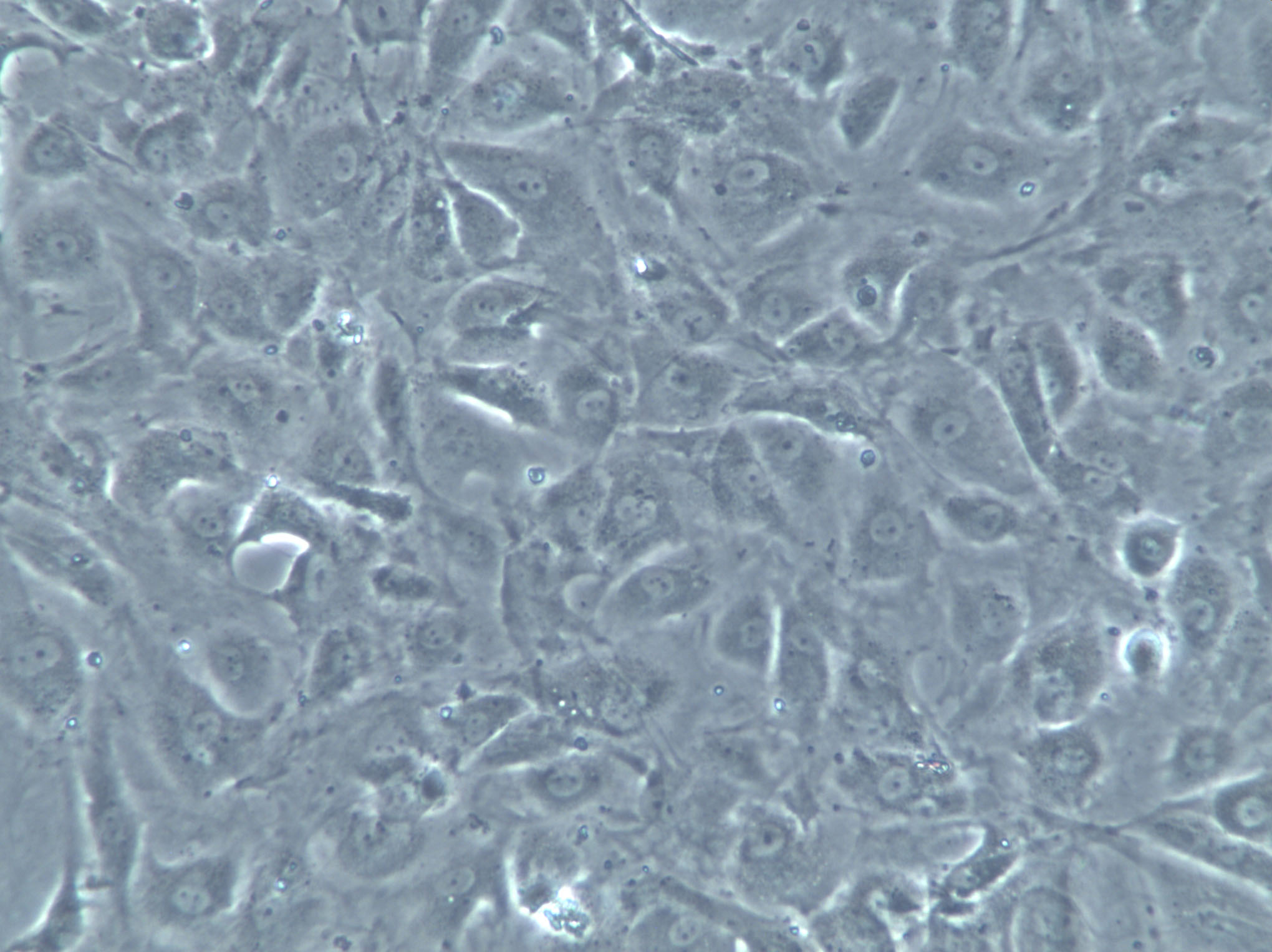 LN-382 Cells(赠送Str鉴定报告)|人脑胶质瘤细胞,LN-382 Cells