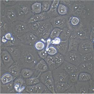 SNU-886 Cells|人肝癌克隆细胞