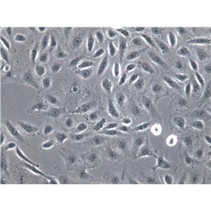 NUGC-4 Cells(赠送Str鉴定报告)|人胃癌细胞