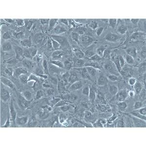 LN-382 Cells(赠送Str鉴定报告)|人脑胶质瘤细胞