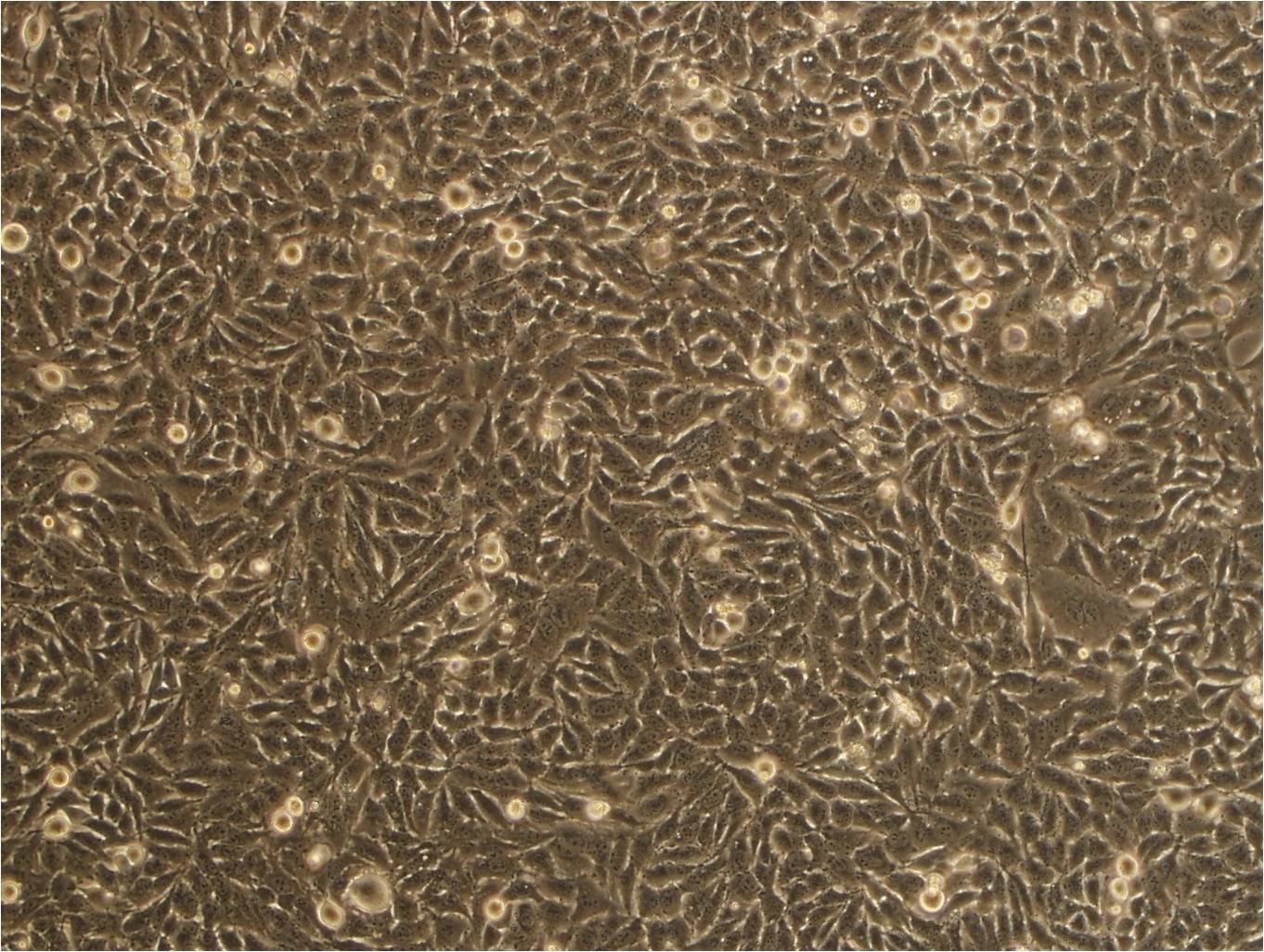 SHIN-3 Cells(赠送Str鉴定报告)|人卵巢浆液性囊腺癌细胞,SHIN-3 Cells
