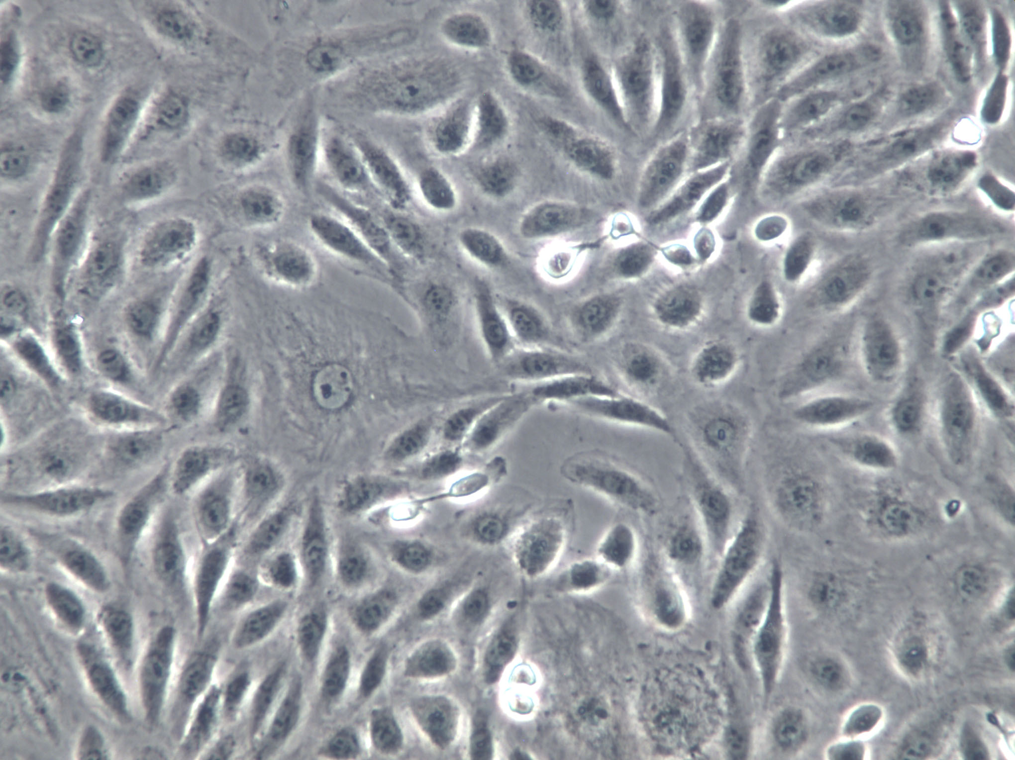 CZ-1 Cells(赠送Str鉴定报告)|人多发性骨髓瘤细胞,CZ-1 Cells