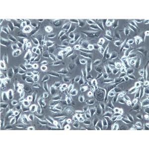 HHUA Cells(赠送Str鉴定报告)|人子宫内膜癌细胞