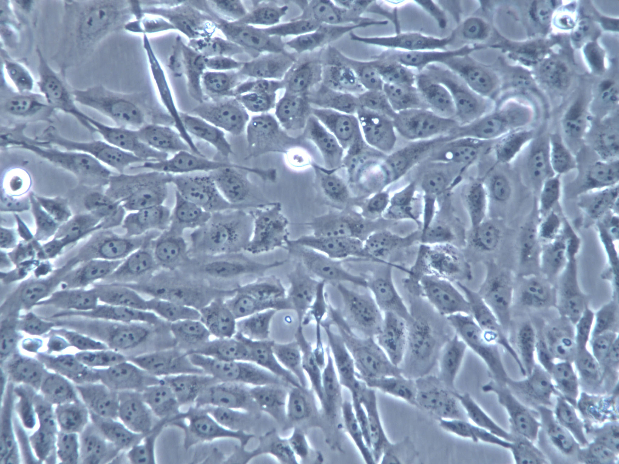 DSL-6A/C1 Cells(赠送Str鉴定报告)|大鼠胰腺癌细胞,DSL-6A/C1 Cells