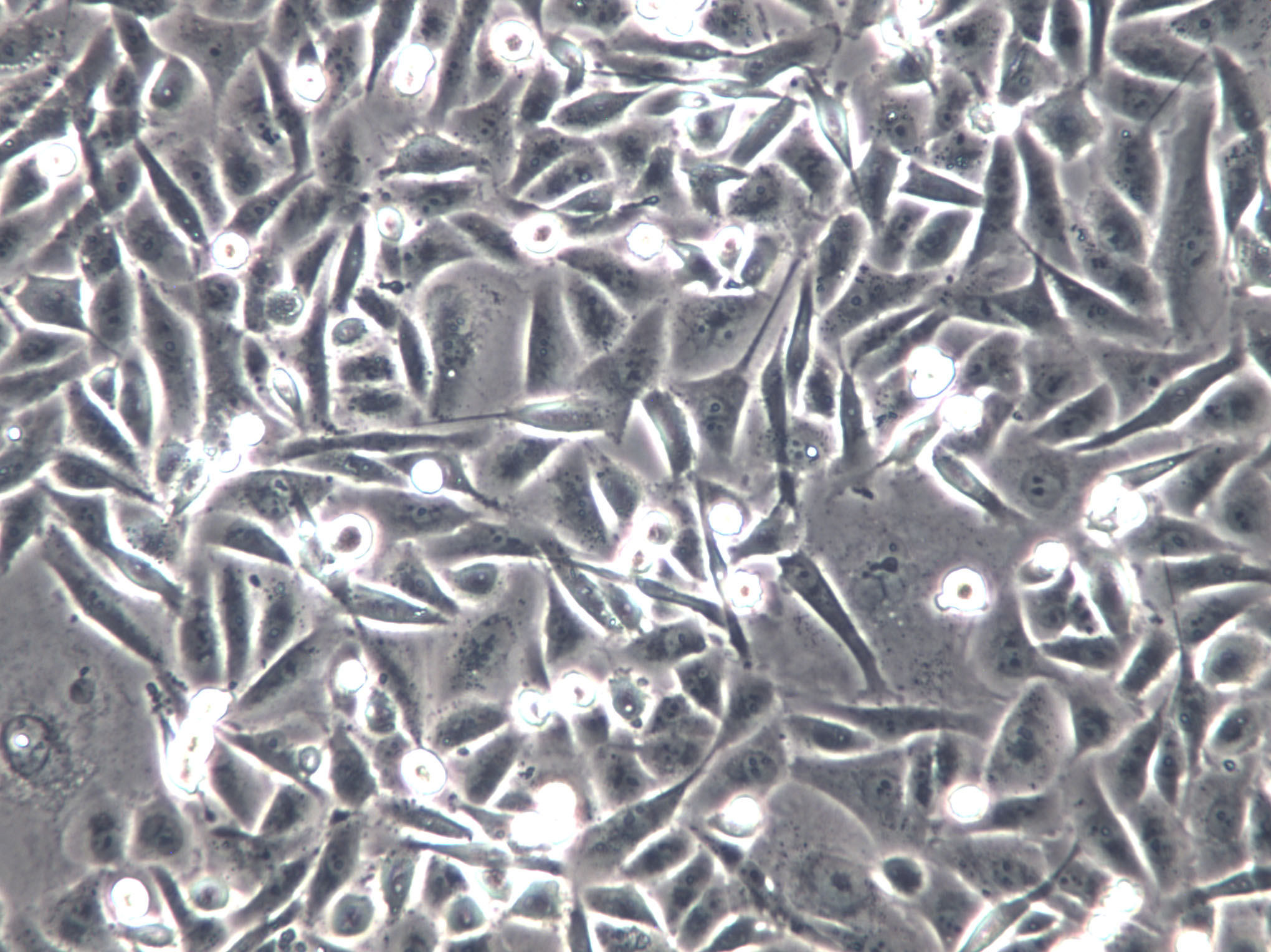 ZR-75-30 Cells|人乳腺癌克隆细胞,ZR-75-30 Cells