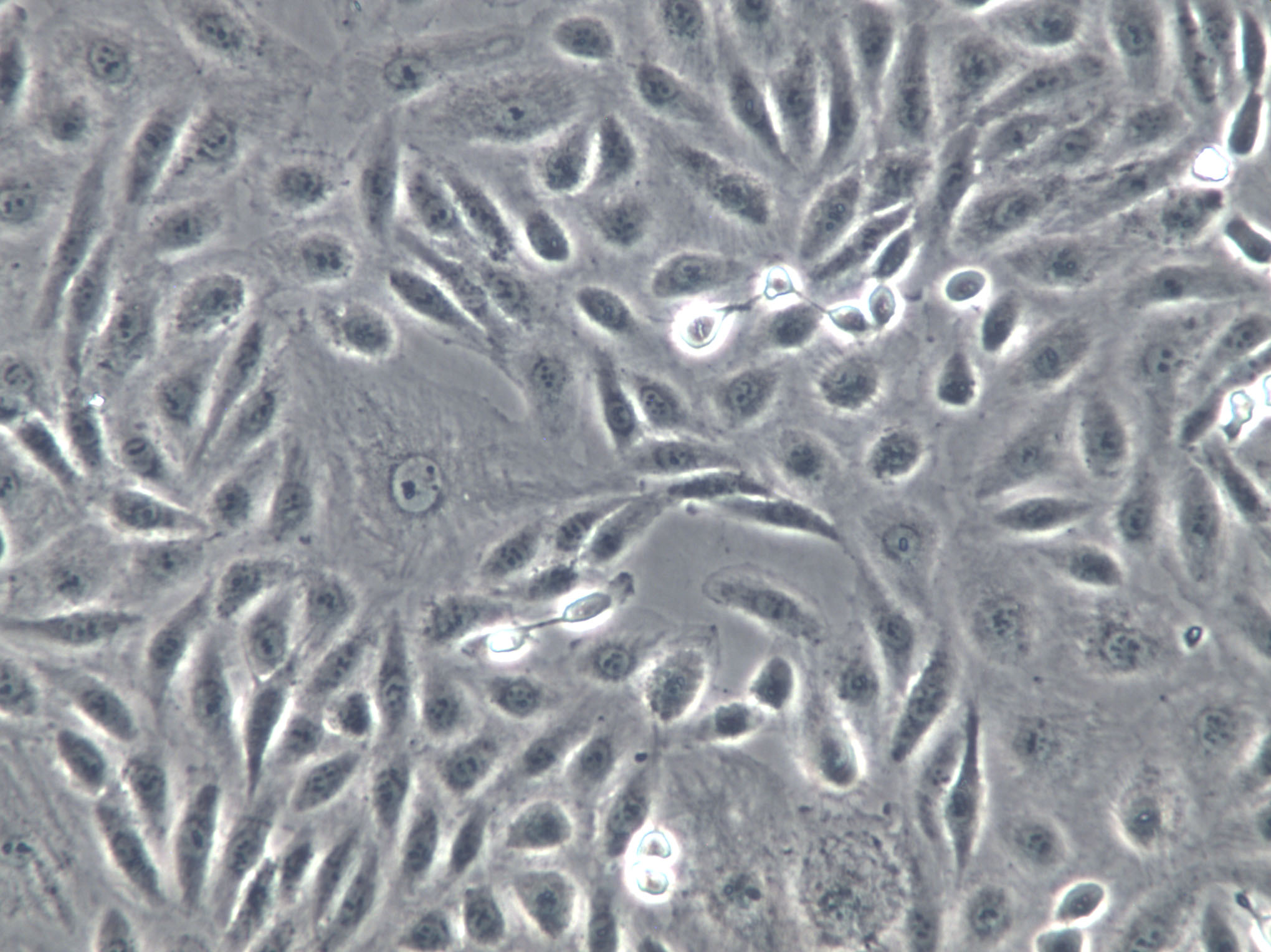 253J Cells(赠送Str鉴定报告)|人膀胱癌细胞,253J Cells