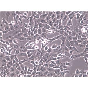 KYSE-50 Cells(赠送Str鉴定报告)|低分化人食管鳞癌细胞