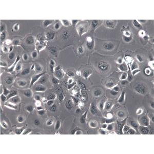 NPC-TW01 Cells(赠送Str鉴定报告)|人鼻咽癌细胞