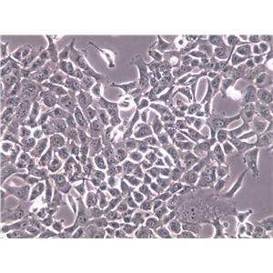 NL20 Cells(赠送Str鉴定报告)|人支气管上皮细胞