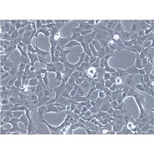 Tca8113 Cells(赠送Str鉴定报告)|人舌鳞癌细胞