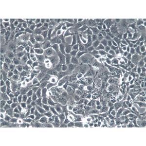 PG-BE1 Cells(赠送Str鉴定报告)|人肺巨细胞癌高转移细胞,PG-BE1 Cells
