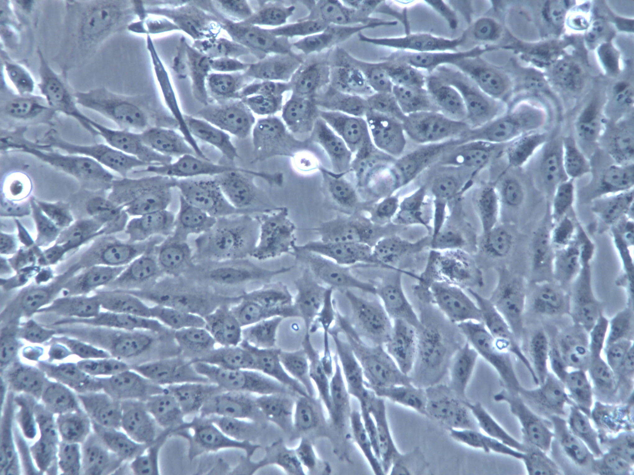 ECC-1 Cells(赠送Str鉴定报告)|人子宫内膜腺癌细胞,ECC-1 Cells