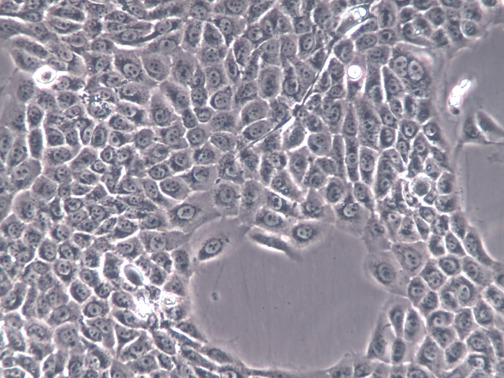 Walker-256-TC Cells(赠送Str鉴定报告)|大鼠乳腺癌细胞,Walker-256-TC Cells