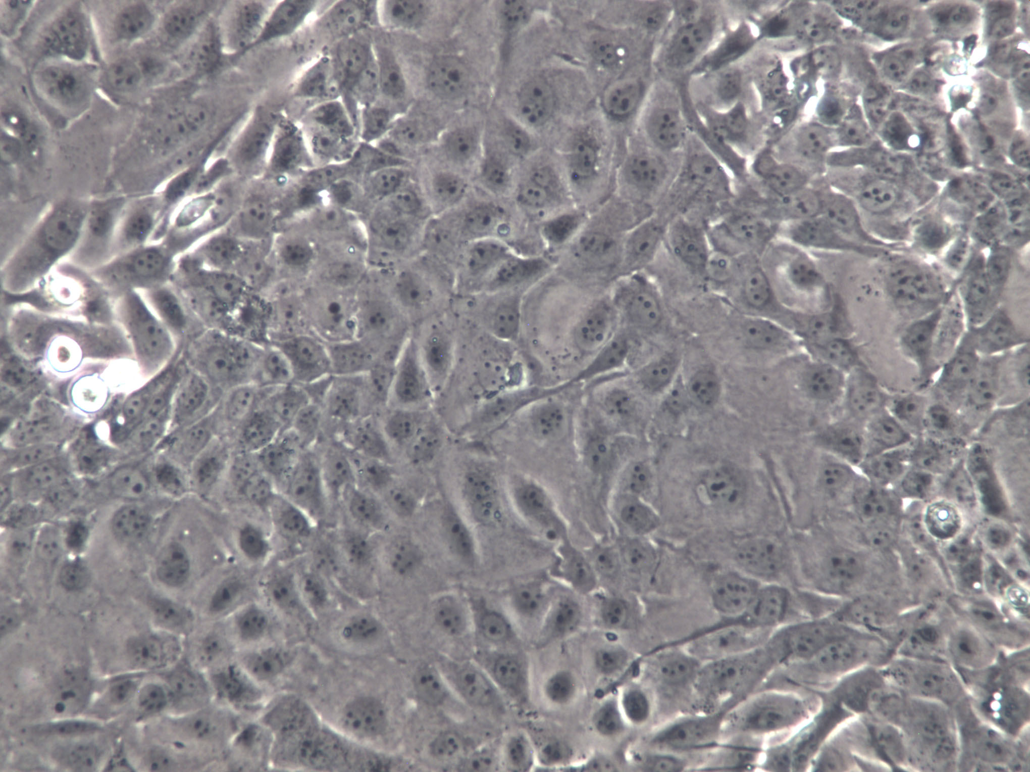 CL1-5 Cells(贈送Str鑒定報告)|人肺腺癌細胞,CL1-5 Cells