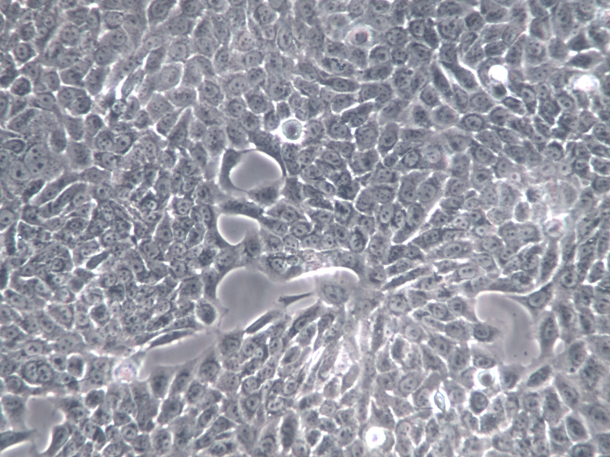 SV40 MES 13 Cells|小鼠肾小球系膜克隆细胞,SV40 MES 13 Cells