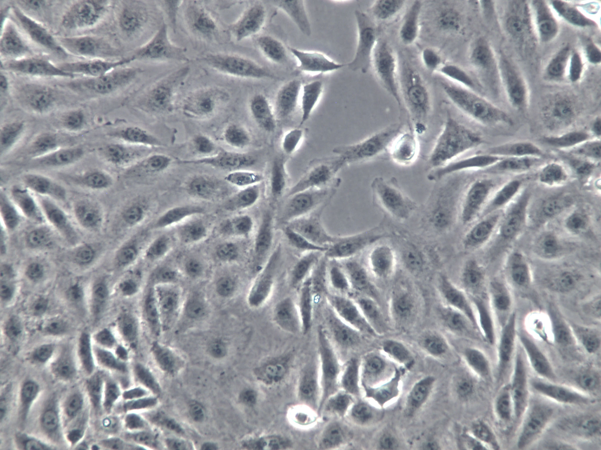 hCMEC/D3 Cells|永生化人脑微血管内皮克隆细胞,hCMEC/D3 Cells