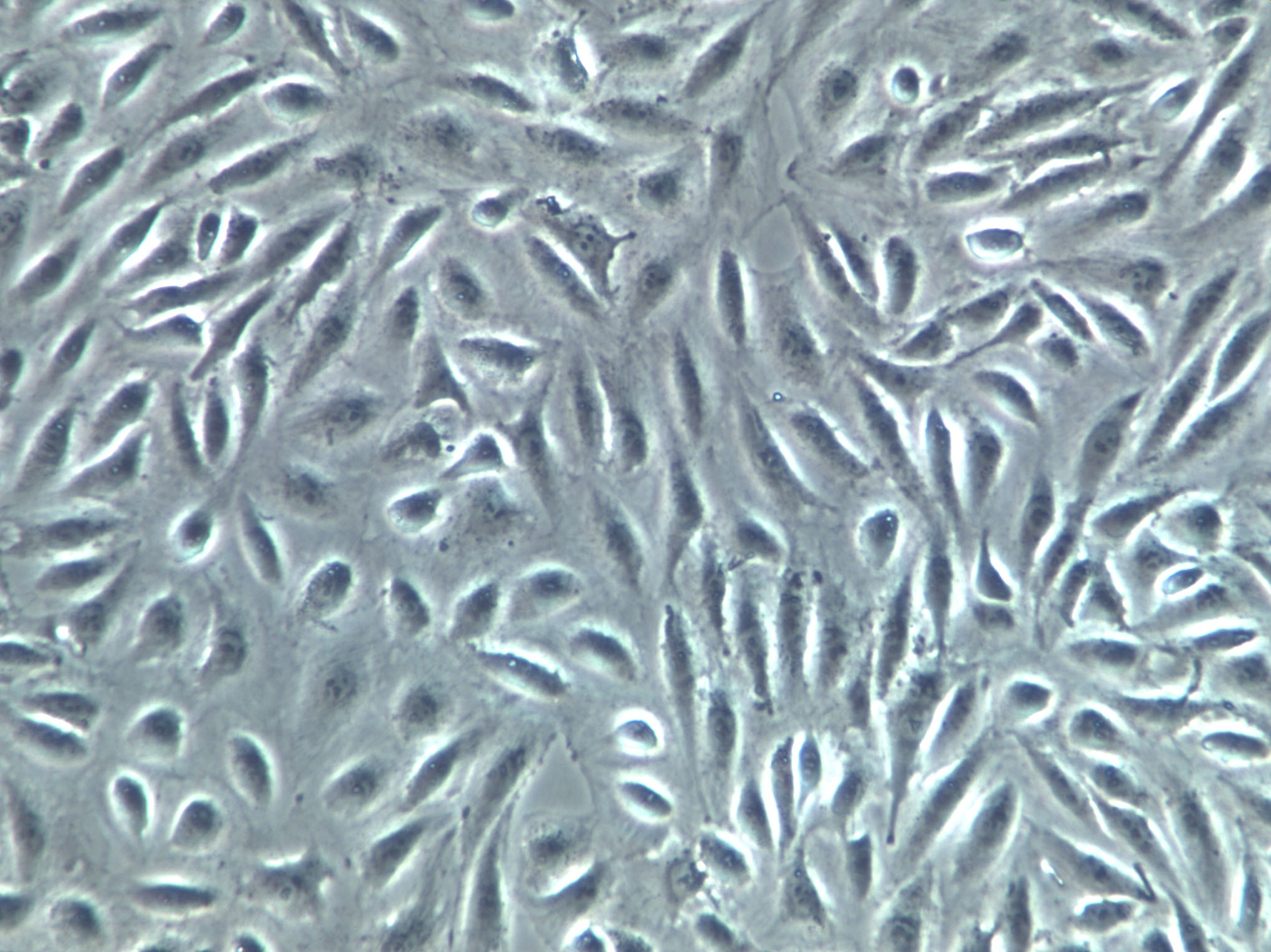 IHH-4 Cells(赠送Str鉴定报告)|人甲状腺癌细胞,IHH-4 Cells