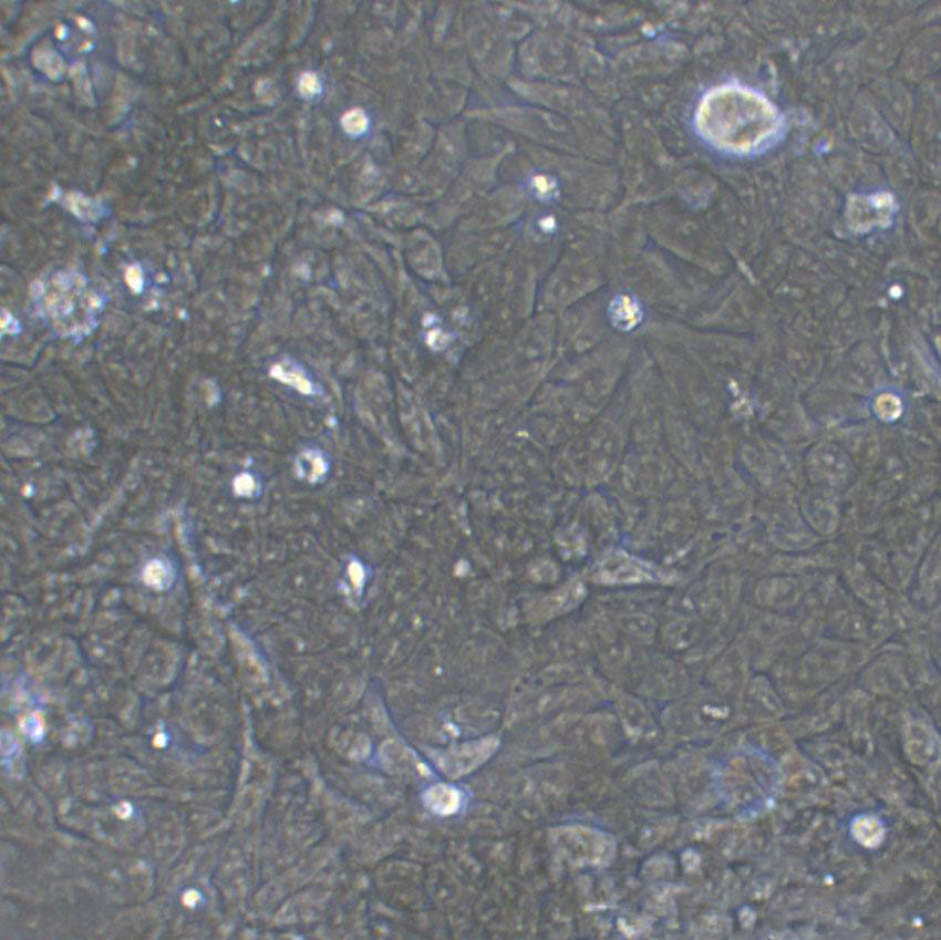 OCM-1 Cells(赠送Str鉴定报告)|人眼脉络膜黑色素瘤细胞,OCM-1 Cells