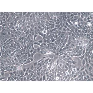 SV40 MES 13 Cells|小鼠肾小球系膜克隆细胞
