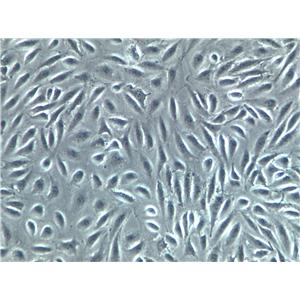 A375-SM Cells(赠送Str鉴定报告)|人恶性黑色素瘤细胞