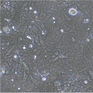 OCM-1 Cells(赠送Str鉴定报告)|人眼脉络膜黑色素瘤细胞